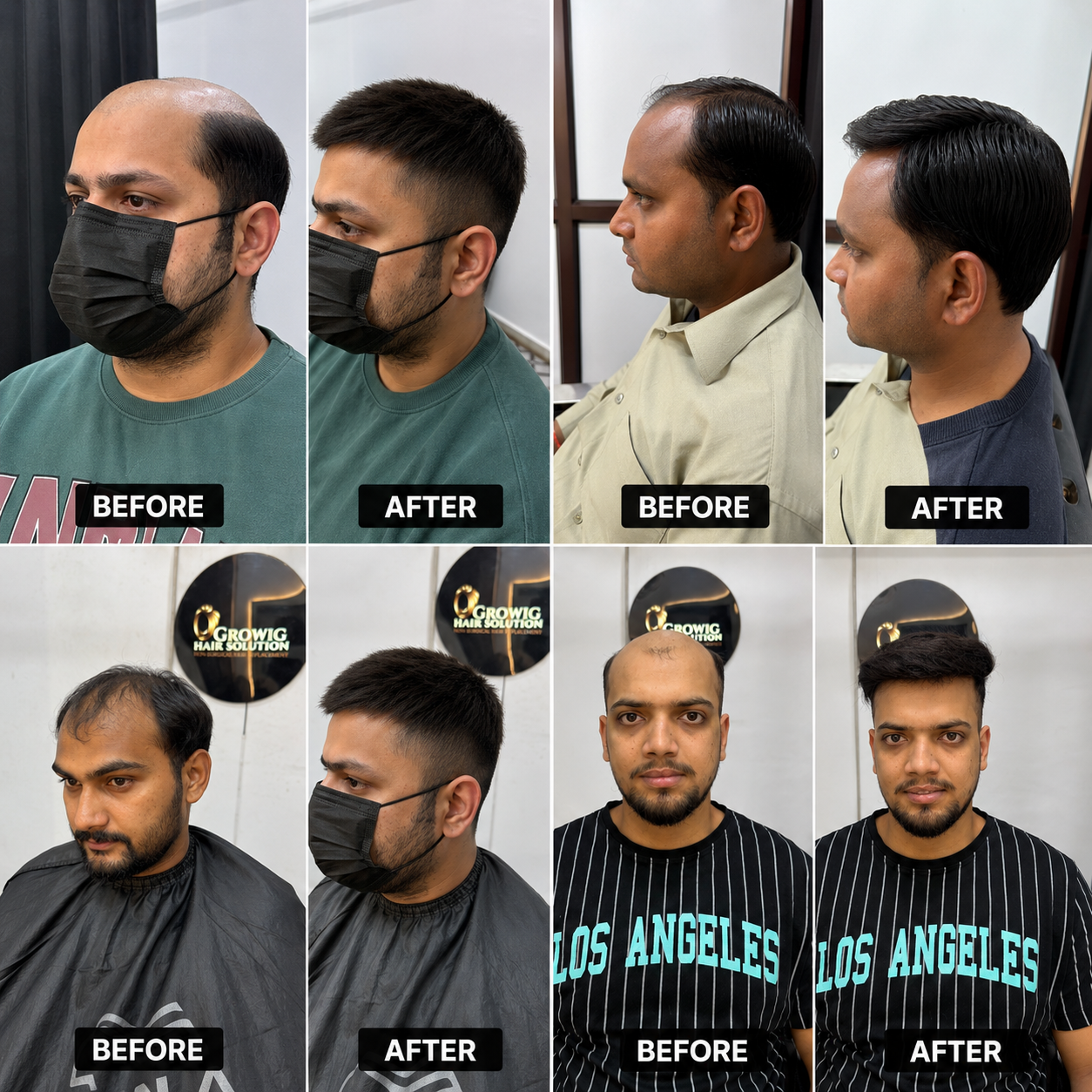 Bespoke Hair Replacement