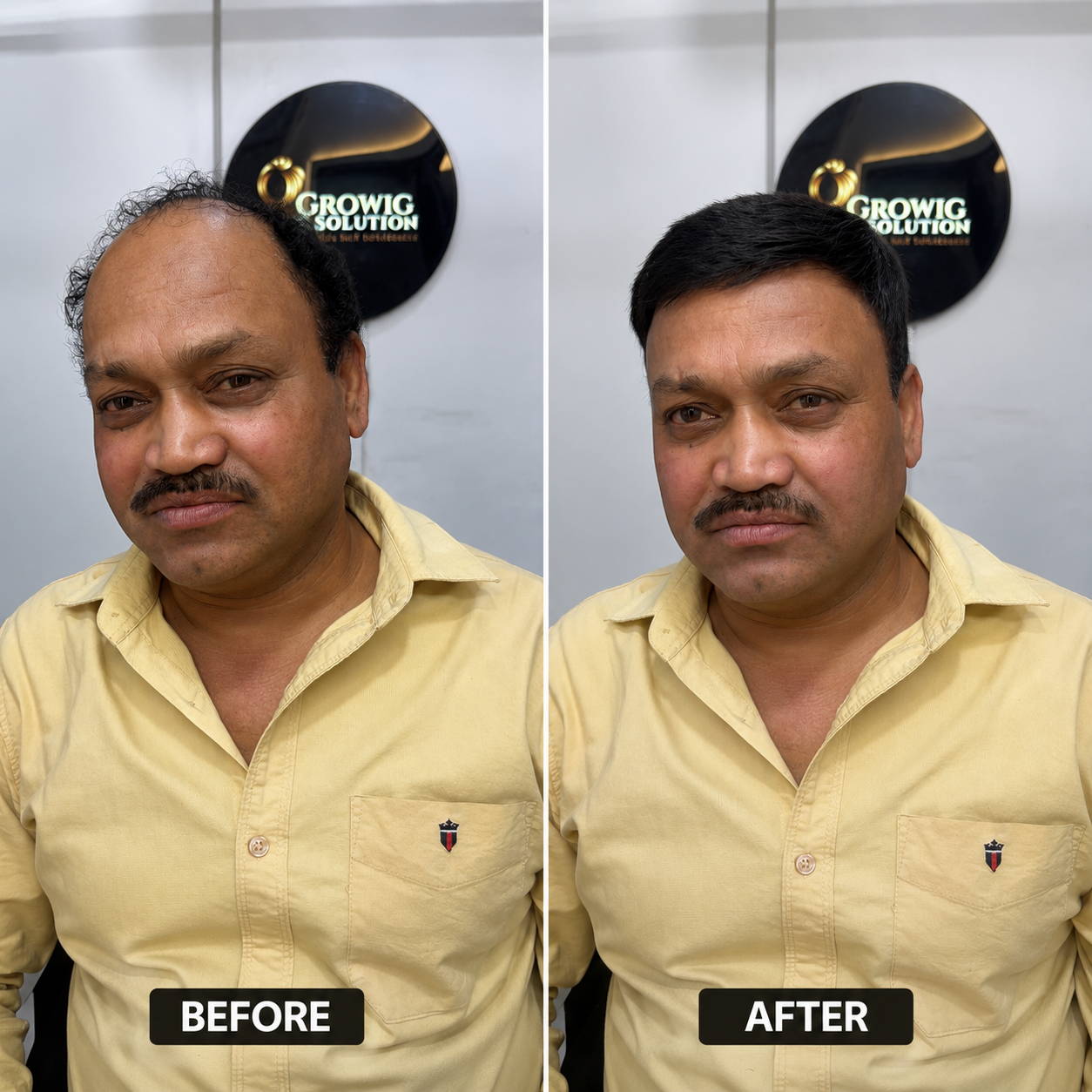 Bespoke Hair Patch - Before and After