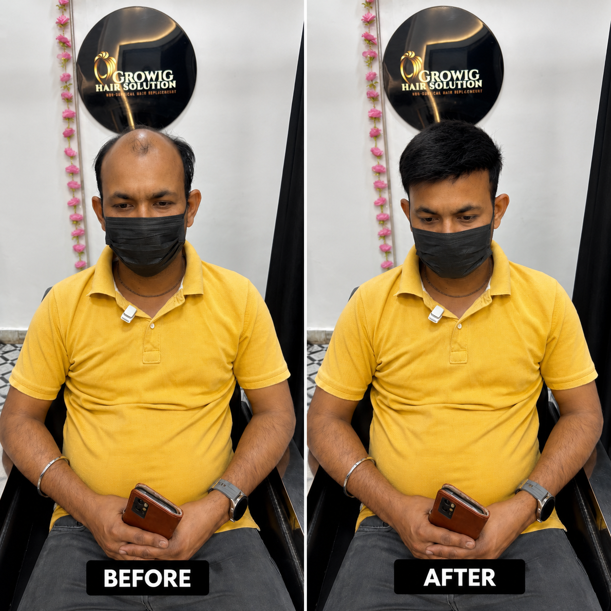Premium Hair Bonding - Before and After